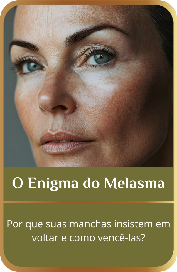 O enigma do melasma. Por que suas manchas insistem em voltar e como vencê-las?