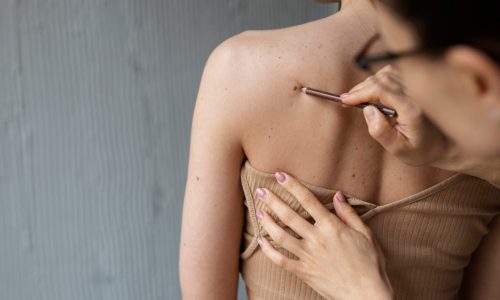 female-doctor-diagnosing-melanoma-body-female-patient