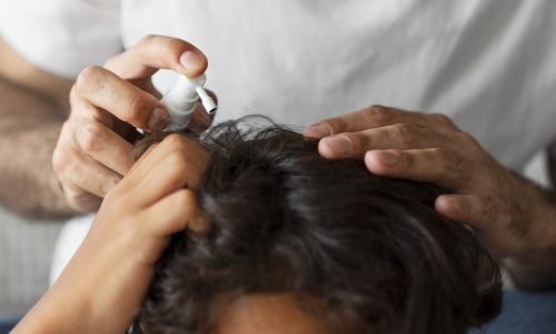 high-angle-hand-holding-lice-treatment