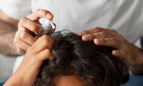 high-angle-hand-holding-lice-treatment