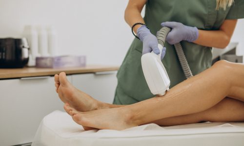 Laser epilation, hair removal therapy