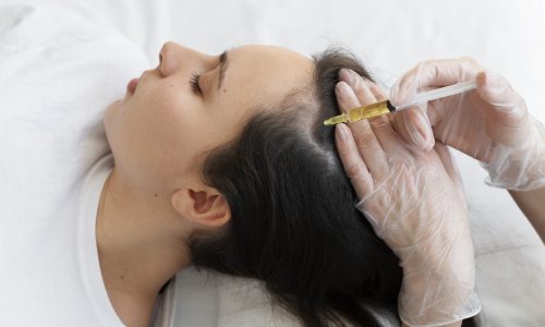 woman-getting-scalp-prp-treatment-high-angle