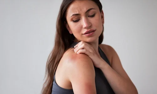woman-suffering-from-rash-scaled