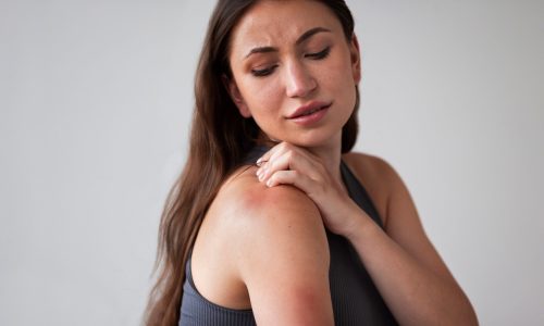 woman-suffering-from-rash